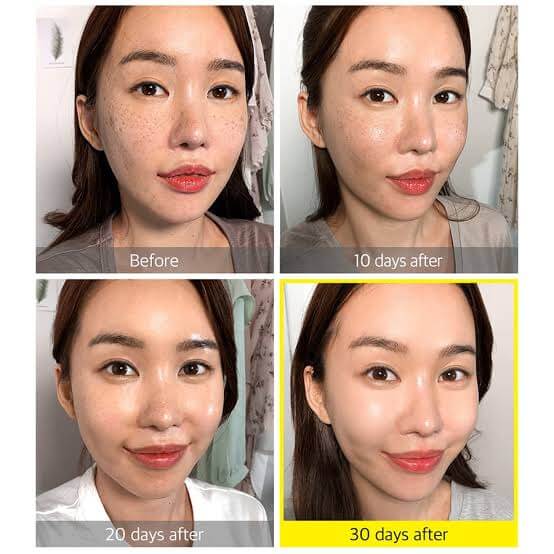 Some by mi Yuja Niacin 30 Days Blemish Care Serum,some by mi yuja niacin serum,some by mi yuja niacin serum รีวิว,some by mi yuja niacin blemish care serum review,some by mi เซรั่มส้ม,some by mi yuja niacin,